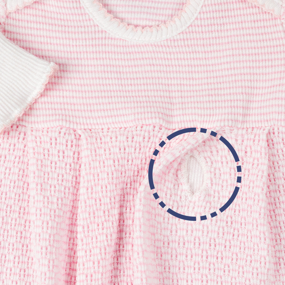 Close-up of discreet PatyPort G-tube access opening hidden in pink baby gown pleats